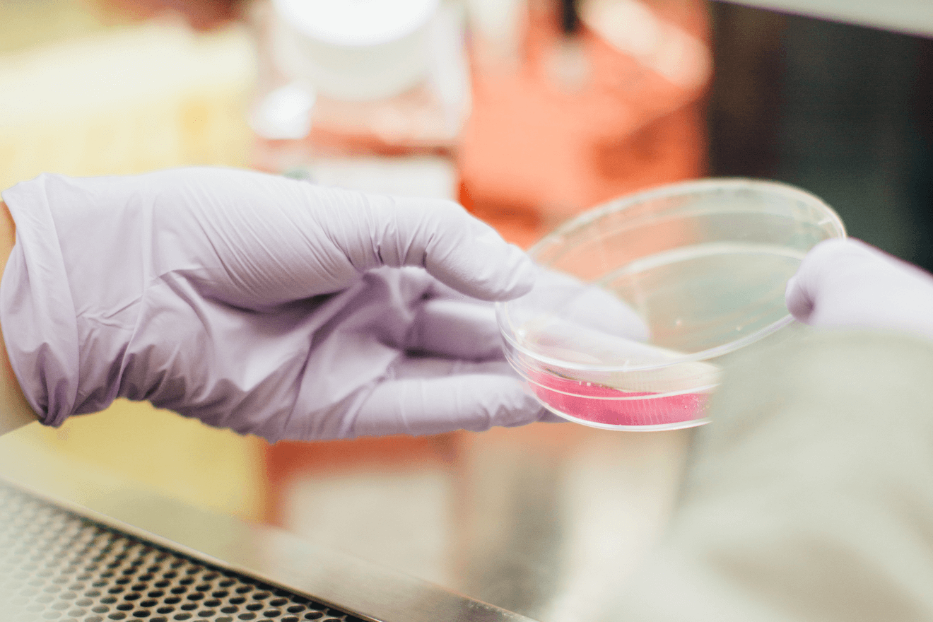 Latex glove with petri dish